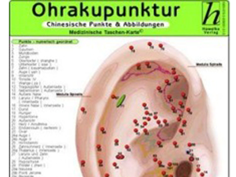 Ohrakupunktur