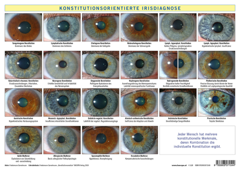 A4 Tafel Konstitutionsorientierte Irisdiagnose